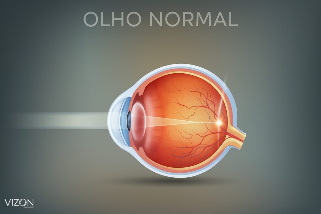 olho normal