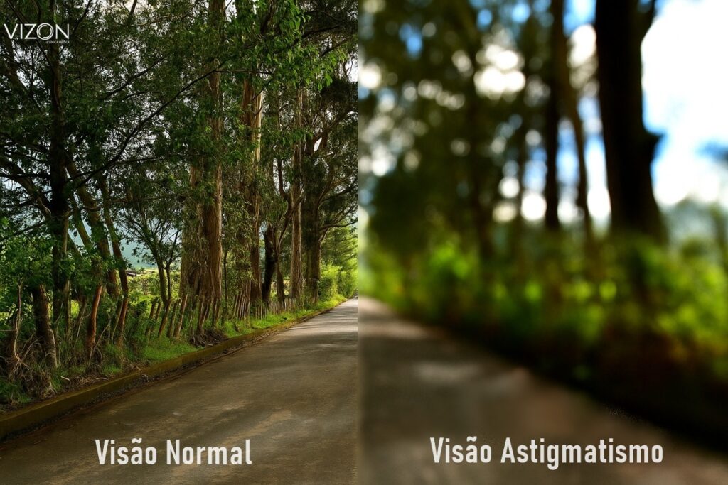 visão astigmatismo